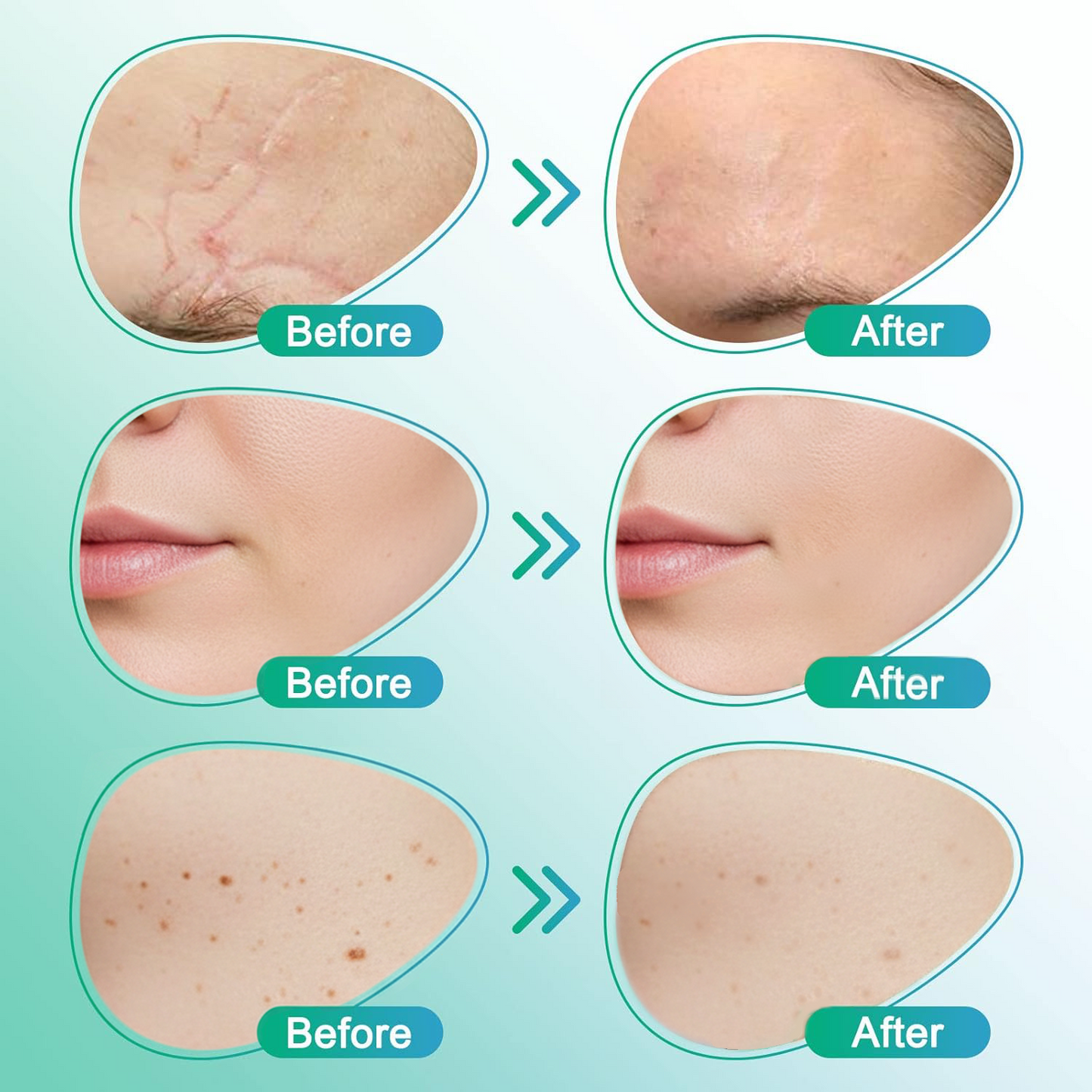 TAILEDEN™ 3-in-1 Microneedle Care Patch