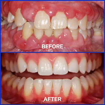 Alisanda® VioCore Dental Treatment Toothpaste