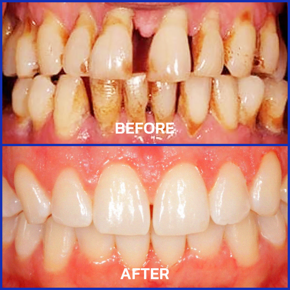 Alisanda® VioCore Dental Treatment Toothpaste