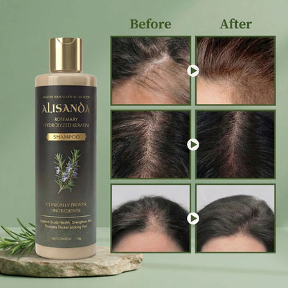 🔥LAST DAY 70% OFF🔥Alisanda® Rosemary Shampoo – Now Upgraded for Superior Hair Growth!