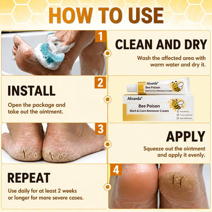 👨‍⚕️Alisanda®Bee Poison Wart & Corn Remover Cream⚡