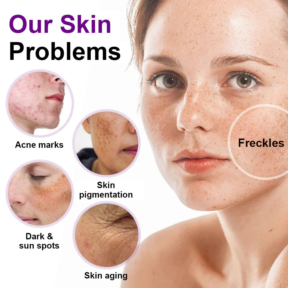 Alisanda® SpotErase Probiotic Shield Serum 20 d32108e1 d84f 40b3 baa6 9cd2b48ae091