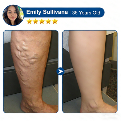 🇺🇸👨‍⚕️✅TAILEDEN® 𝑽𝗲𝗶𝙣 𝘾𝐨𝐧𝘁𝗼𝙪𝙧 𝙈𝙞𝐜𝐫𝒐𝒏𝒆𝗲𝗱𝗹𝙚 𝙋𝙖𝐭𝐜𝒉 𝒘𝒊𝘁𝗵 𝗔𝙙𝙫𝙖𝙣𝙘𝐞𝐝 𝐃𝒊𝒐𝒔𝗺𝙞𝐧 & 𝑯𝒆𝘀𝗽𝗲𝙧𝙞𝙙𝙞𝐧 𝐃𝒆𝒍𝒊𝒗𝗲𝗿𝙮🌿𝟕-𝐃𝐚𝐲 𝐕𝐢𝐬𝐢𝐛𝐥𝐞 𝐑𝐞𝐬𝐮𝐥𝐭𝐬 𝐟𝐨𝐫 𝐕𝐚𝐫𝐢𝐜𝐨𝐬𝐞 𝐕𝐞𝐢𝐧𝐬