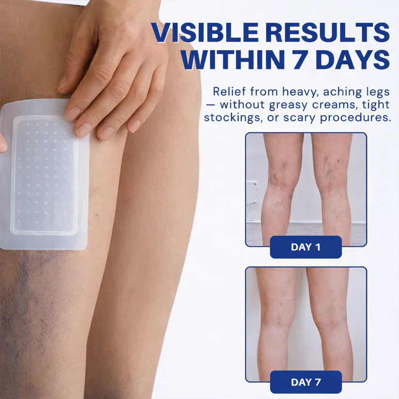 🇺🇸👨‍⚕️✅TAILEDEN® 𝑽𝗲𝗶𝙣 𝘾𝐨𝐧𝘁𝗼𝙪𝙧 𝙈𝙞𝐜𝐫𝒐𝒏𝒆𝗲𝗱𝗹𝙚 𝙋𝙖𝐭𝐜𝒉 𝒘𝒊𝘁𝗵 𝗔𝙙𝙫𝙖𝙣𝙘𝐞𝐝 𝐃𝒊𝒐𝒔𝗺𝙞𝐧 & 𝑯𝒆𝘀𝗽𝗲𝙧𝙞𝙙𝙞𝐧 𝐃𝒆𝒍𝒊𝒗𝗲𝗿𝙮🌿𝟕-𝐃𝐚𝐲 𝐕𝐢𝐬𝐢𝐛𝐥𝐞 𝐑𝐞𝐬𝐮𝐥𝐭𝐬 𝐟𝐨𝐫 𝐕𝐚𝐫𝐢𝐜𝐨𝐬𝐞 𝐕𝐞𝐢𝐧𝐬