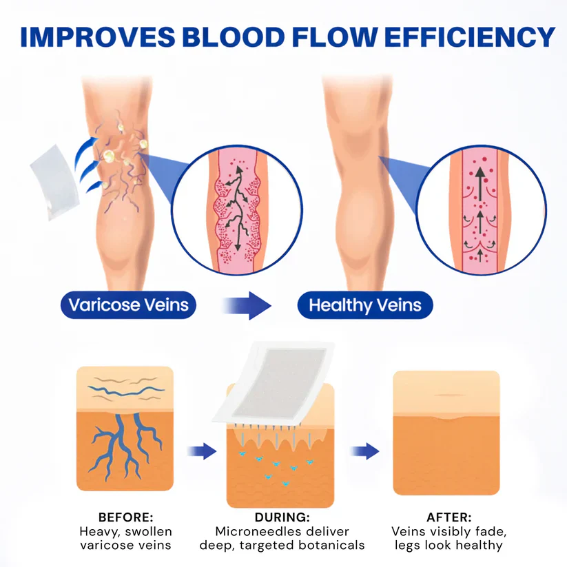🇺🇸👨‍⚕️✅TAILEDEN® 𝑽𝗲𝗶𝙣 𝘾𝐨𝐧𝘁𝗼𝙪𝙧 𝙈𝙞𝐜𝐫𝒐𝒏𝒆𝗲𝗱𝗹𝙚 𝙋𝙖𝐭𝐜𝒉 𝒘𝒊𝘁𝗵 𝗔𝙙𝙫𝙖𝙣𝙘𝐞𝐝 𝐃𝒊𝒐𝒔𝗺𝙞𝐧 & 𝑯𝒆𝘀𝗽𝗲𝙧𝙞𝙙𝙞𝐧 𝐃𝒆𝒍𝒊𝒗𝗲𝗿𝙮🌿𝟕-𝐃𝐚𝐲 𝐕𝐢𝐬𝐢𝐛𝐥𝐞 𝐑𝐞𝐬𝐮𝐥𝐭𝐬 𝐟𝐨𝐫 𝐕𝐚𝐫𝐢𝐜𝐨𝐬𝐞 𝐕𝐞𝐢𝐧𝐬
