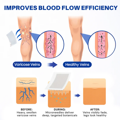 🇺🇸👨‍⚕️✅TAILEDEN® 𝑽𝗲𝗶𝙣 𝘾𝐨𝐧𝘁𝗼𝙪𝙧 𝙈𝙞𝐜𝐫𝒐𝒏𝒆𝗲𝗱𝗹𝙚 𝙋𝙖𝐭𝐜𝒉 𝒘𝒊𝘁𝗵 𝗔𝙙𝙫𝙖𝙣𝙘𝐞𝐝 𝐃𝒊𝒐𝒔𝗺𝙞𝐧 & 𝑯𝒆𝘀𝗽𝗲𝙧𝙞𝙙𝙞𝐧 𝐃𝒆𝒍𝒊𝒗𝗲𝗿𝙮🌿𝟕-𝐃𝐚𝐲 𝐕𝐢𝐬𝐢𝐛𝐥𝐞 𝐑𝐞𝐬𝐮𝐥𝐭𝐬 𝐟𝐨𝐫 𝐕𝐚𝐫𝐢𝐜𝐨𝐬𝐞 𝐕𝐞𝐢𝐧𝐬