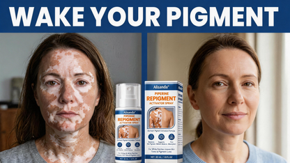 ⚡Alisanda® Piperine Re Pigment Activator Spray to Reactivate Dormant Pigment Cells & Restore Natural Skin Color