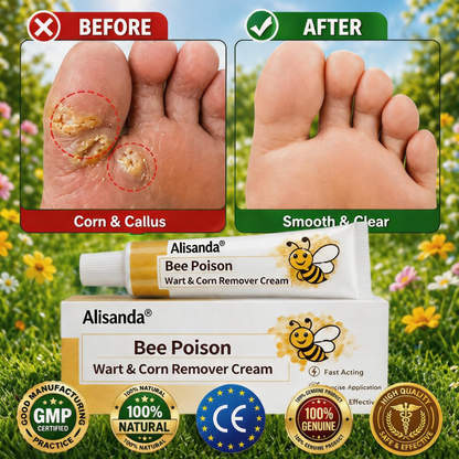 👨‍⚕️Alisanda®Bee Poison Wart & Corn Remover Cream⚡