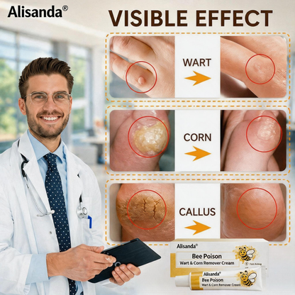 👨‍⚕️Alisanda®Bee Poison Wart & Corn Remover Cream⚡