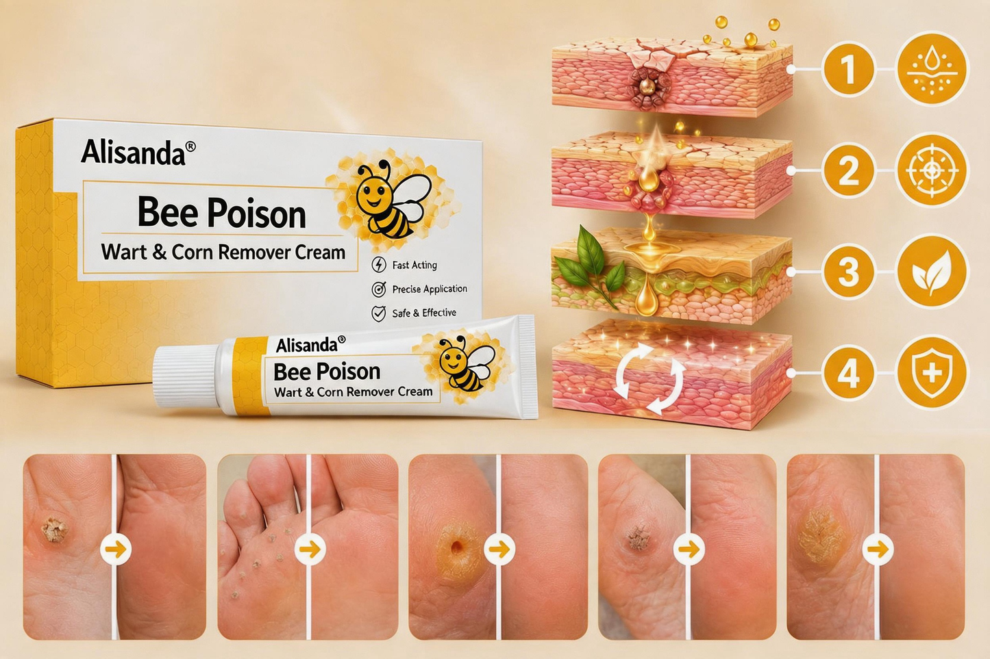 👨‍⚕️Alisanda®Bee Poison Wart & Corn Remover Cream⚡