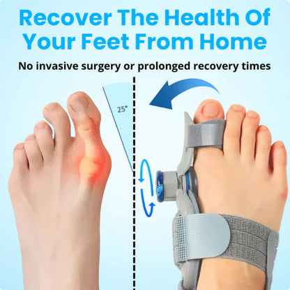 Alisanda® - Non-Surgical Relief for Bunion Pain