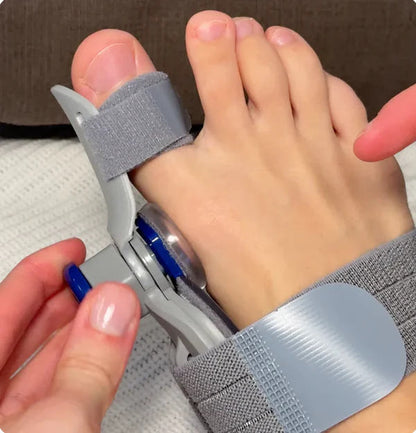 Alisanda® - Non-Surgical Relief for Bunion Pain