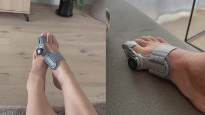Alisanda® - Non-Surgical Relief for Bunion Pain