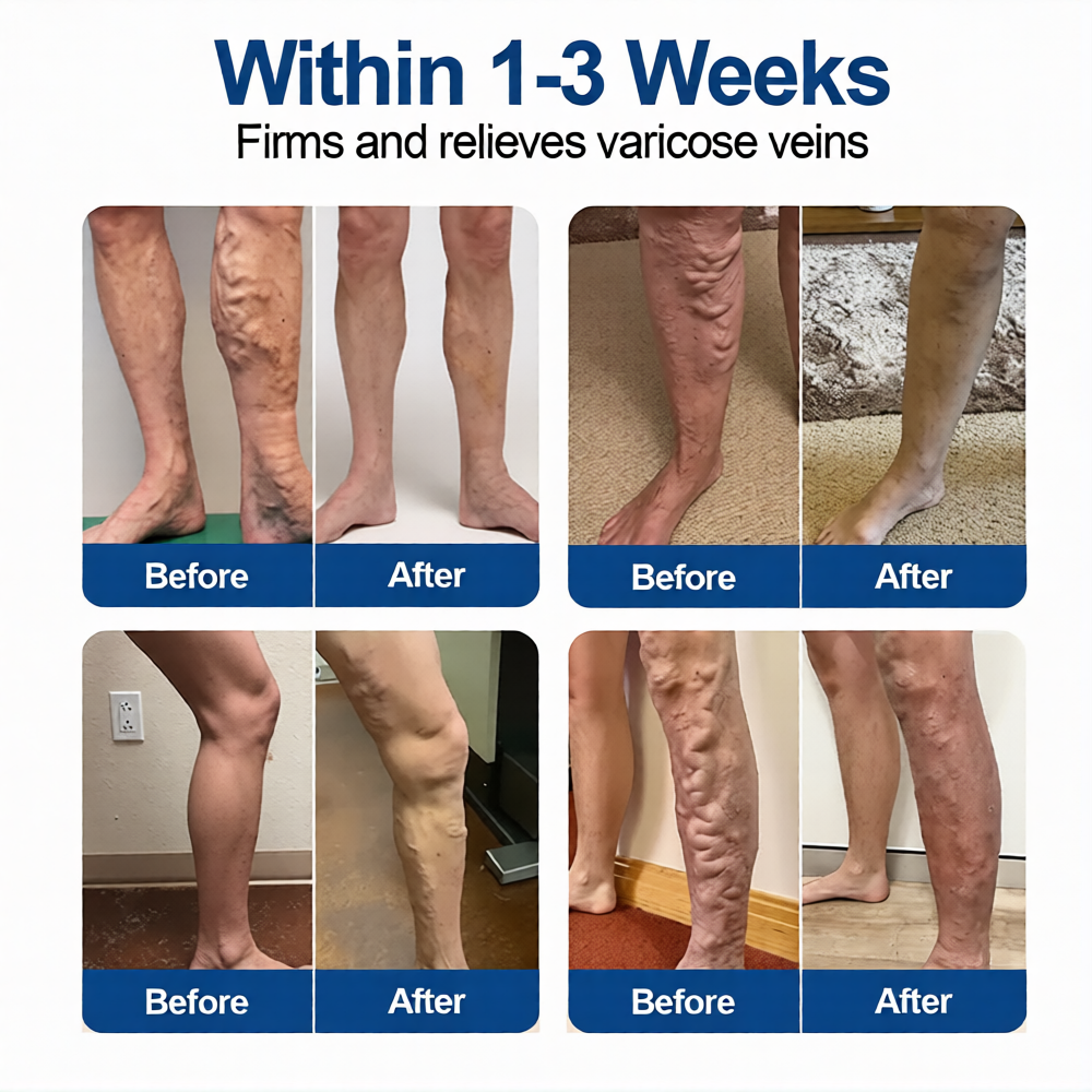 🇺🇸🥇👨‍⚕️✅Alisanda® VeinTarget Microneedle Patch⚡Instant Relief, Long-Term Results